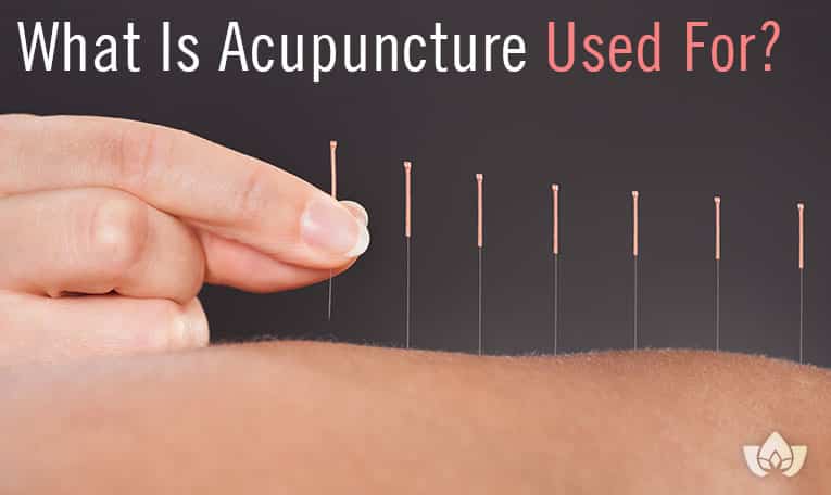 report findings of acupuncture healing