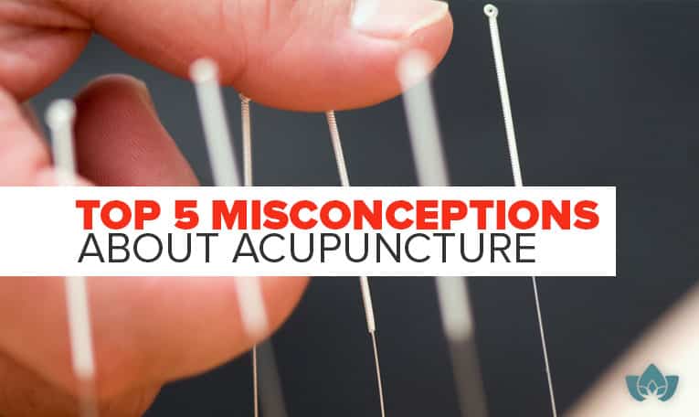 Top 5 Misconceptions About Acupuncture | Close up of hand applying acupuncture needles.