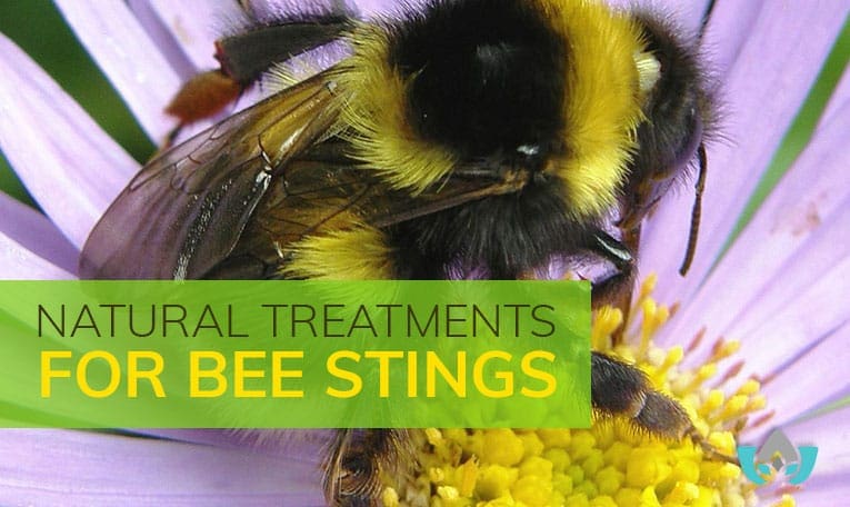 Natural Treatments For Bee Stings | Mindful Healing | Mississauge Naturopathic Doctor