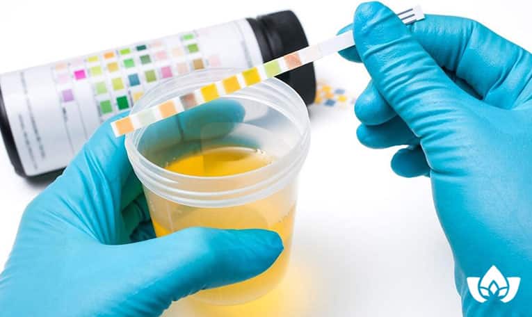 urine test and what it can tell you about your health | Mindful Healing | Naturopathic Doctor Mississauga